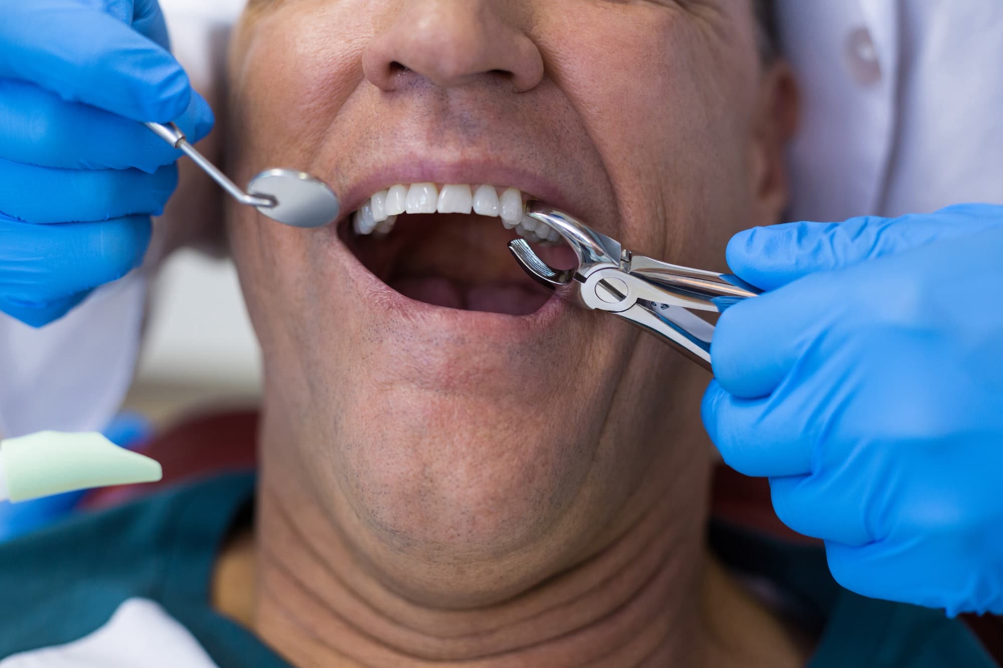 Read more about the article 5 Common Myths About Cosmetic Dentistry