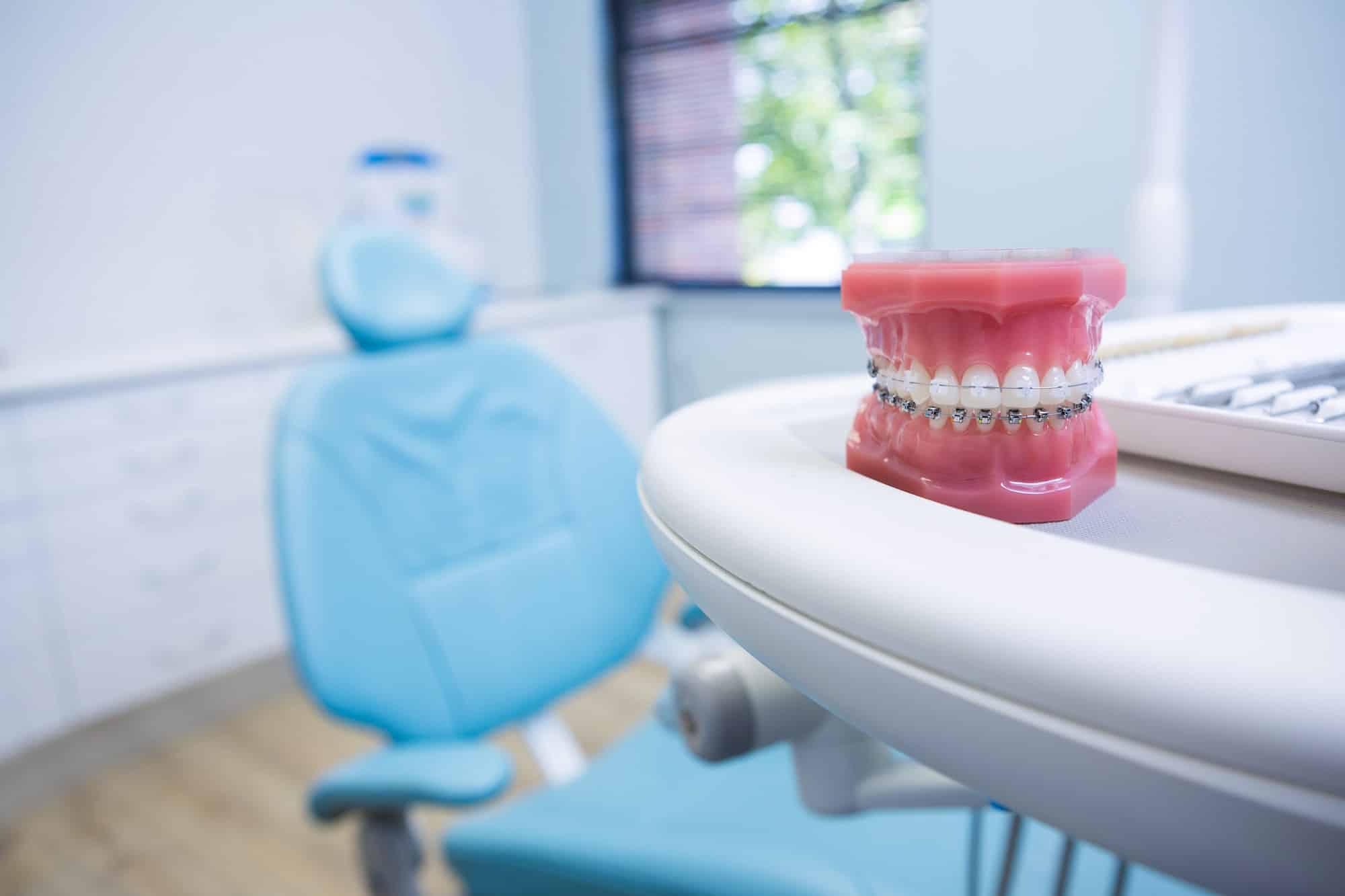 Read more about the article When Do You Need Dental Implants
