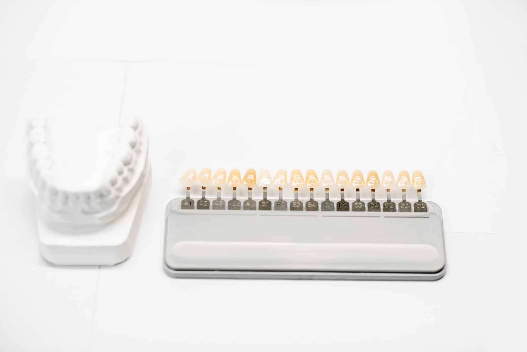 Read more about the article What You Need To Know About Veneers vs. Crowns